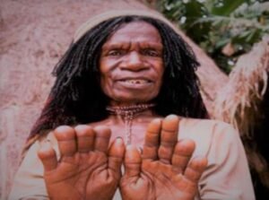 Shake's finger cut off with an ax