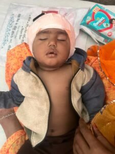 Bikaner News : सरदार पटेल मेडिकल कॉलेज से संबद्ध पीबीएम अस्पताल, बीकानेर के ईएनटी विभाग ने 14 माह के रूद्रप्रताप के दोनों कानों में सफल कॉक्लियर इम्प्लांट करते हुए उसे सुनने व बोलने के योग्य बनाया